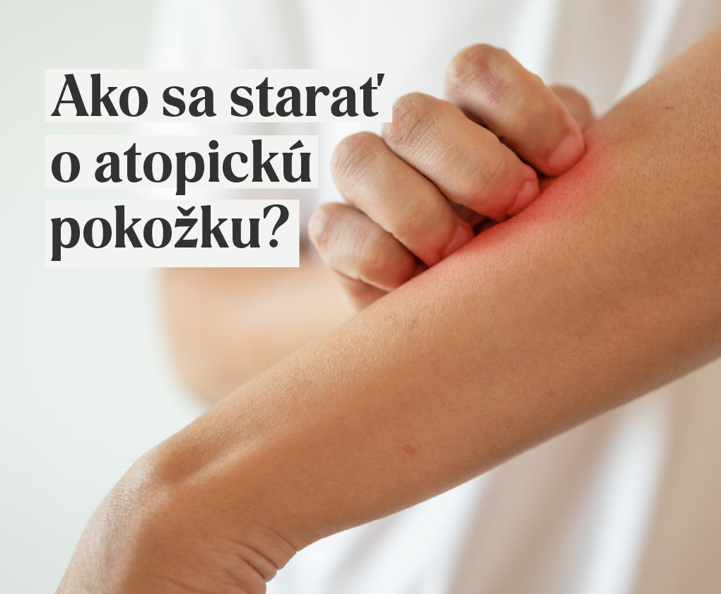 Ako sa starať o atopickú pokožku?